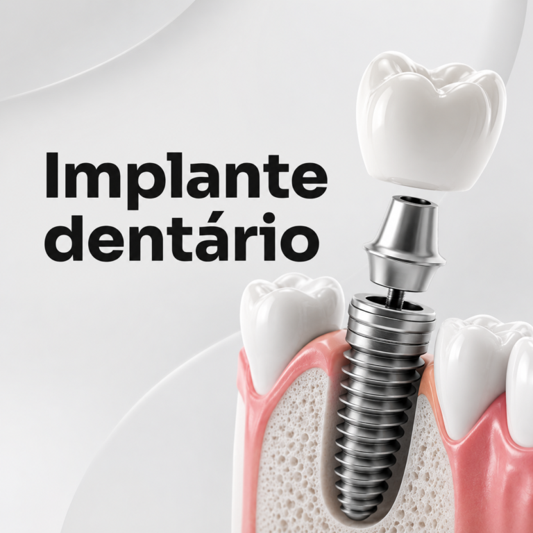 Implante-Dentario.png