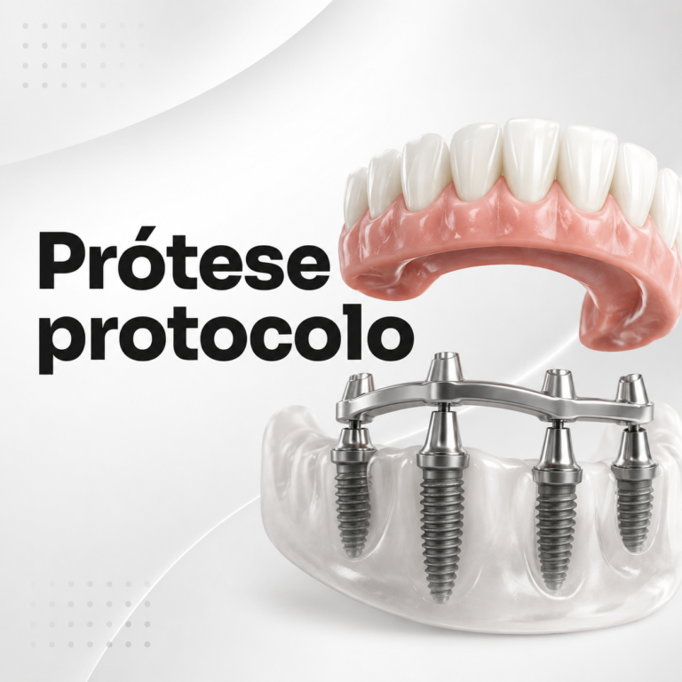 Protese-Protocolo.png